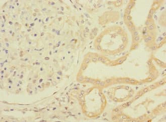 PPIAL4G Antibody