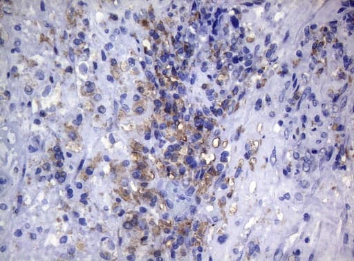 CTSL / Cathepsin L Antibody (clone OTI8H2)