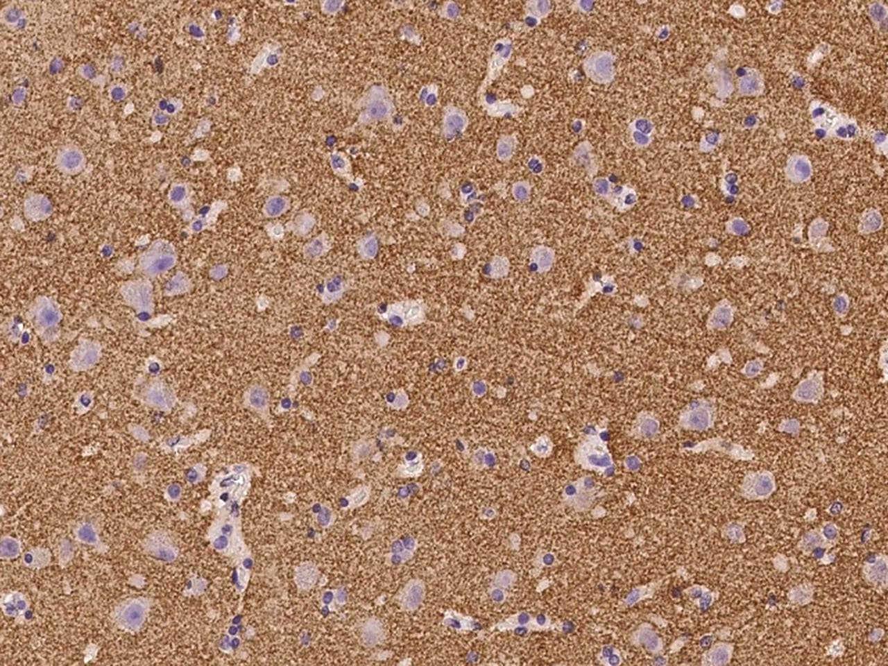 Polyclonal Rabbit anti-Human SYNGR3 / Synaptogyrin 3 Antibody (IHC)