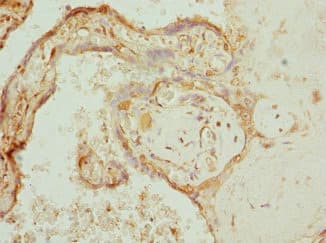 COX10 Antibody
