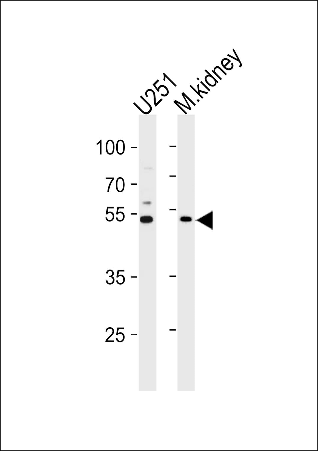 IHC-plus™ Polyclonal Rabbit anti-Human C1GALT1 Antibody (aa115-144, IHC, WB)