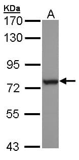 IHC-plus™ Polyclonal Rabbit anti-Human HSPA6 / HSP70B' Antibody (aa377-628, IHC, WB)