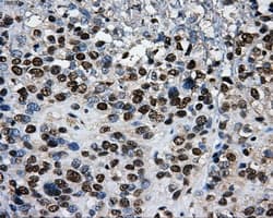 PKMYT1 Antibody (clone OTI5E1)
