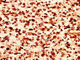 HIST1H1C Antibody
