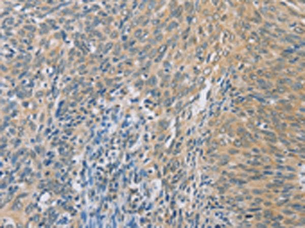 Polyclonal Rabbit anti-Human ZHX3 Antibody (IHC)