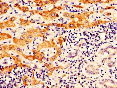 Polyclonal Rabbit anti-Human OTC Antibody (aa33-354)