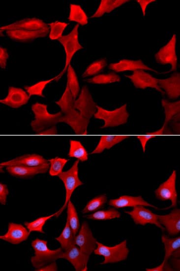 GCLM Antibody