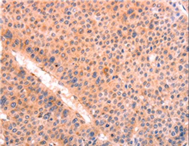 Leptin Antibody