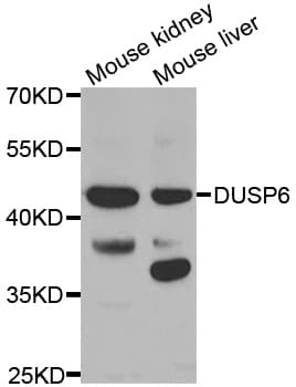 DUSP6 / MKP3 Antibody