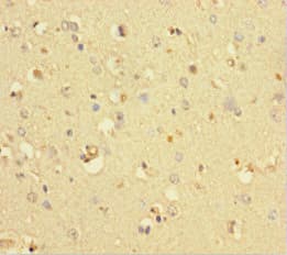 COMMD6 Antibody