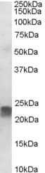 IHC-plus™ TAGLN / Transgelin / SM22 Antibody (aa190-201)