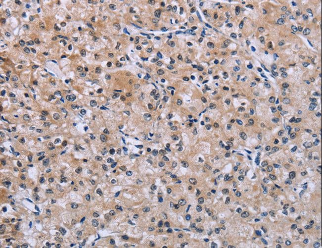 Polyclonal Rabbit anti-Human SLC1A6 / EAAT4 Antibody (IHC, WB)