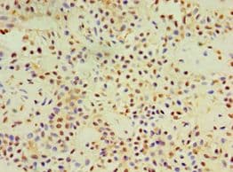 Polyclonal Rabbit anti-Human DACT3 Antibody (aa1-160, IHC)