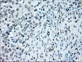 BRAF / B-Raf Antibody (clone OTI4C5)