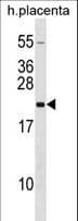 Polyclonal Rabbit anti-Human GH2 Antibody (aa19-45, WB)