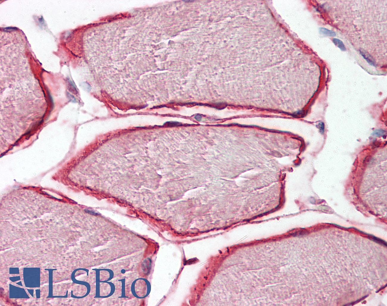 IHC-plus™ Polyclonal Goat anti-Human CAV3 / Caveolin 3 Antibody (aa5-18, IHC, WB)