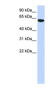 Polyclonal Rabbit anti-Human CFAP53 / CCDC11 Antibody (N-Terminus, WB)