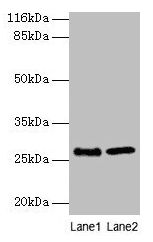 EBP Antibody (aa2-230)