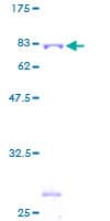 Human TRIM21 / RO52 Protein (Recombinant GST)