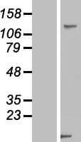 USP33 / VDU1 Protein (Over-Expression Lysate Myc-DDK (Flag))