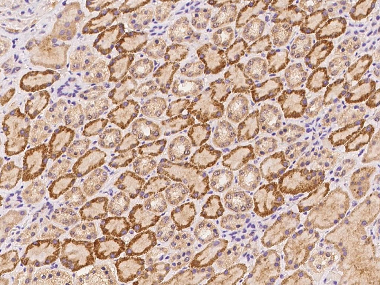 COL5A3 / Collagen V Alpha 3 Antibody