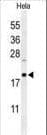 Polyclonal Rabbit anti-Human CLEC2B / AICL Antibody (aa59-86, WB)