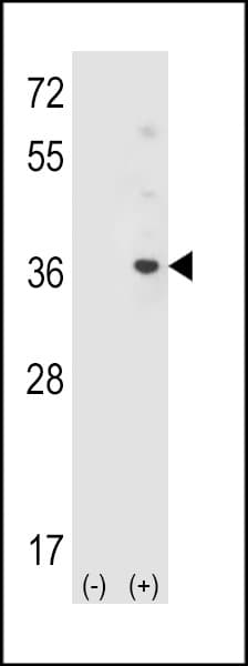 ATG10 Antibody (aa96-121)
