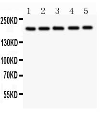 Tuberin / TSC2 Antibody (aa1611-1807)