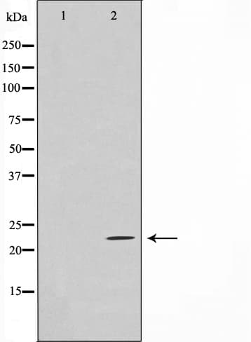 Polyclonal Rabbit anti-Human EFNA2 / Ephrin A2 Antibody (IF, WB)