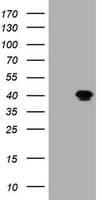 MAGEB1 Antibody (clone OTI7D9)