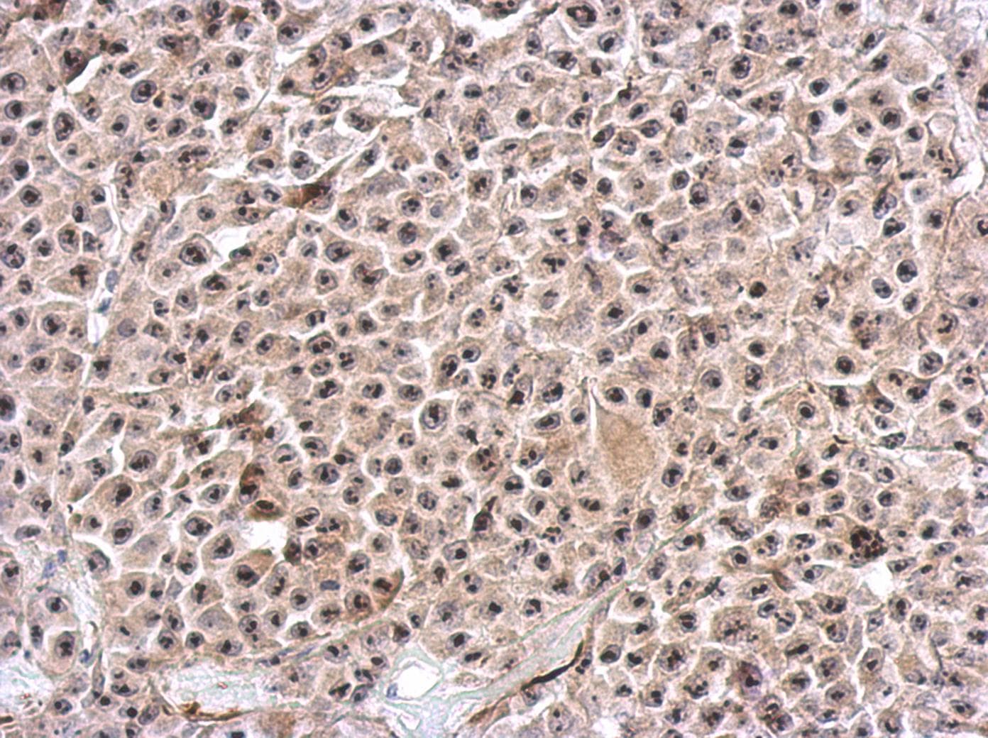 KIAA0020 / PEN Antibody