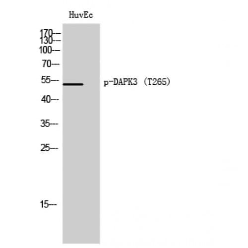 DAPK3 / ZIP Kinase Antibody (210-290 aa)