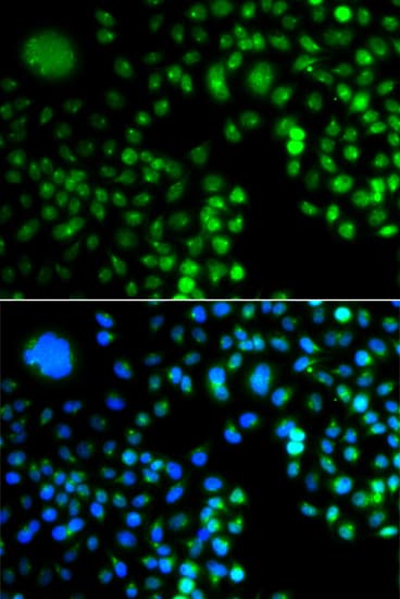 PRDM5 Antibody