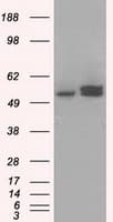 IHC-plus™ ATP5B / ATP Synthase Beta Antibody (clone 5G2)