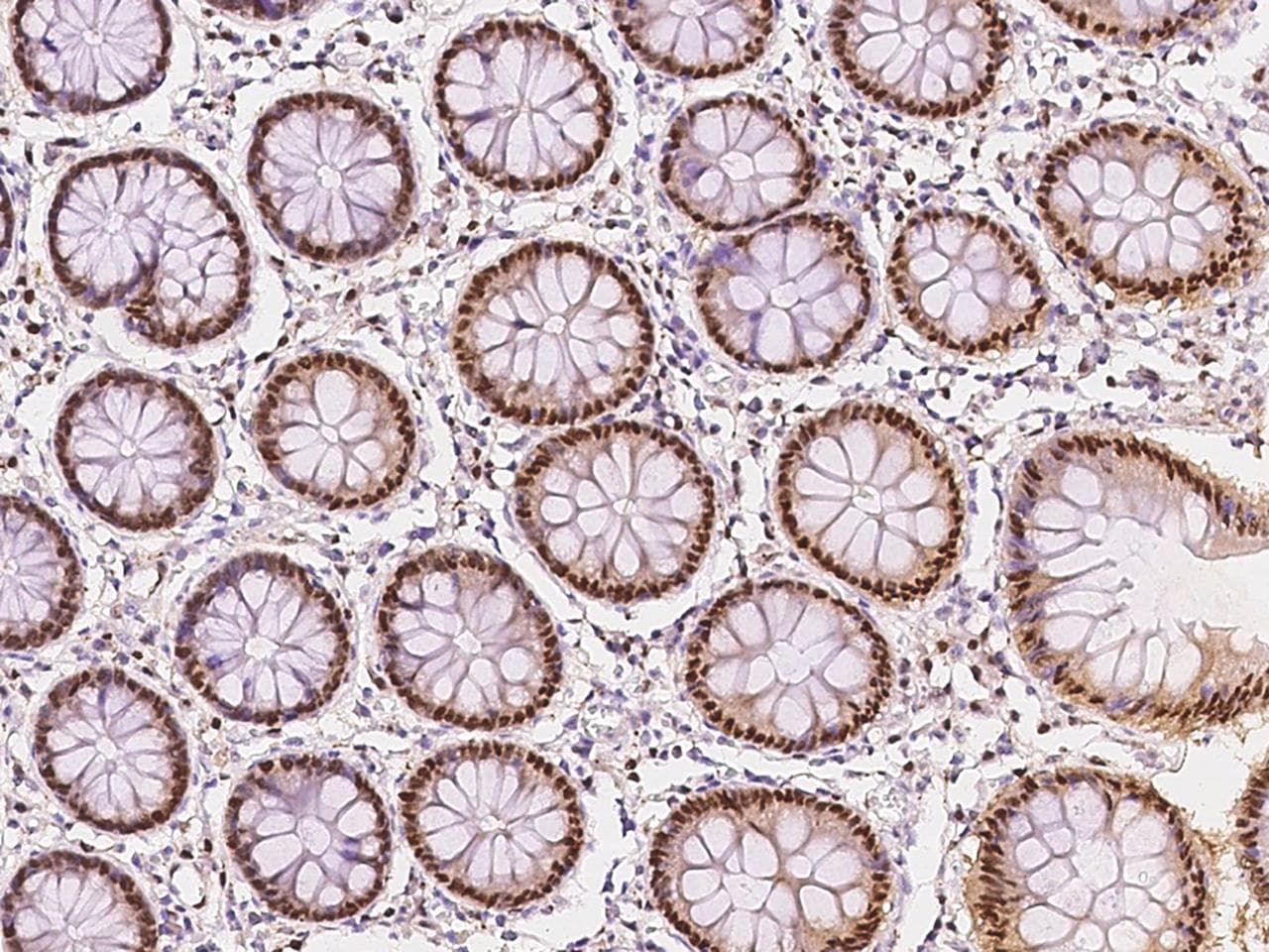 ERCC6L / FLJ20105 Antibody