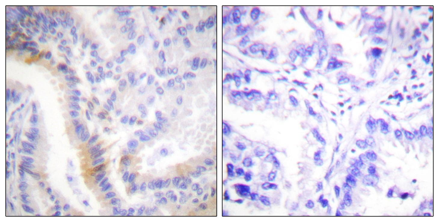 UCN / Urocortin Antibody