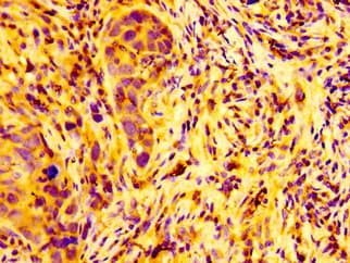 Polyclonal Rabbit anti-Human ARFGEF2 / BIG2 Antibody (IHC, IF, WB)