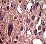 Polyclonal Rabbit anti-Human FNTB Antibody (aa6-36, IHC, WB)