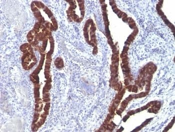 KRT7 / CK7 / Cytokeratin 7 Antibody (clone K72.7)