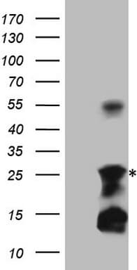 TNF Alpha Antibody (clone OTI4B9)