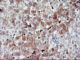 SERPINB3 Antibody (clone OTI2B11)