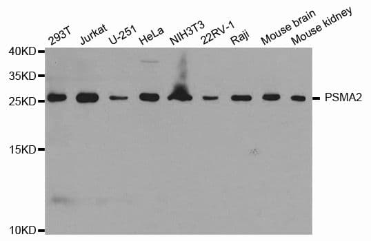 PSMA2 Antibody