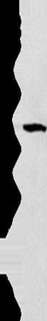 ZADH2 Antibody