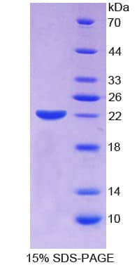 Human ECT2 Protein (Recombinant His)