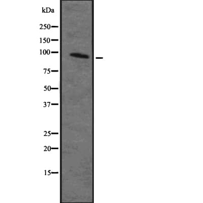 Polyclonal Rabbit anti-Human GCK / Germinal Center Kinase Antibody (IHC, WB)