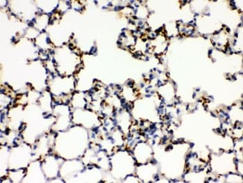 Polyclonal Rabbit anti-Human ITGA2B / CD41 Antibody (IHC, WB)
