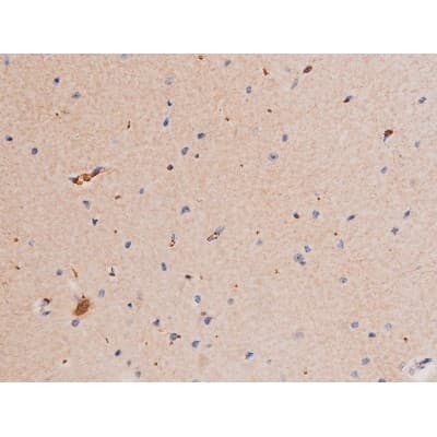 STAT1 Antibody (phospho-Ser727)
