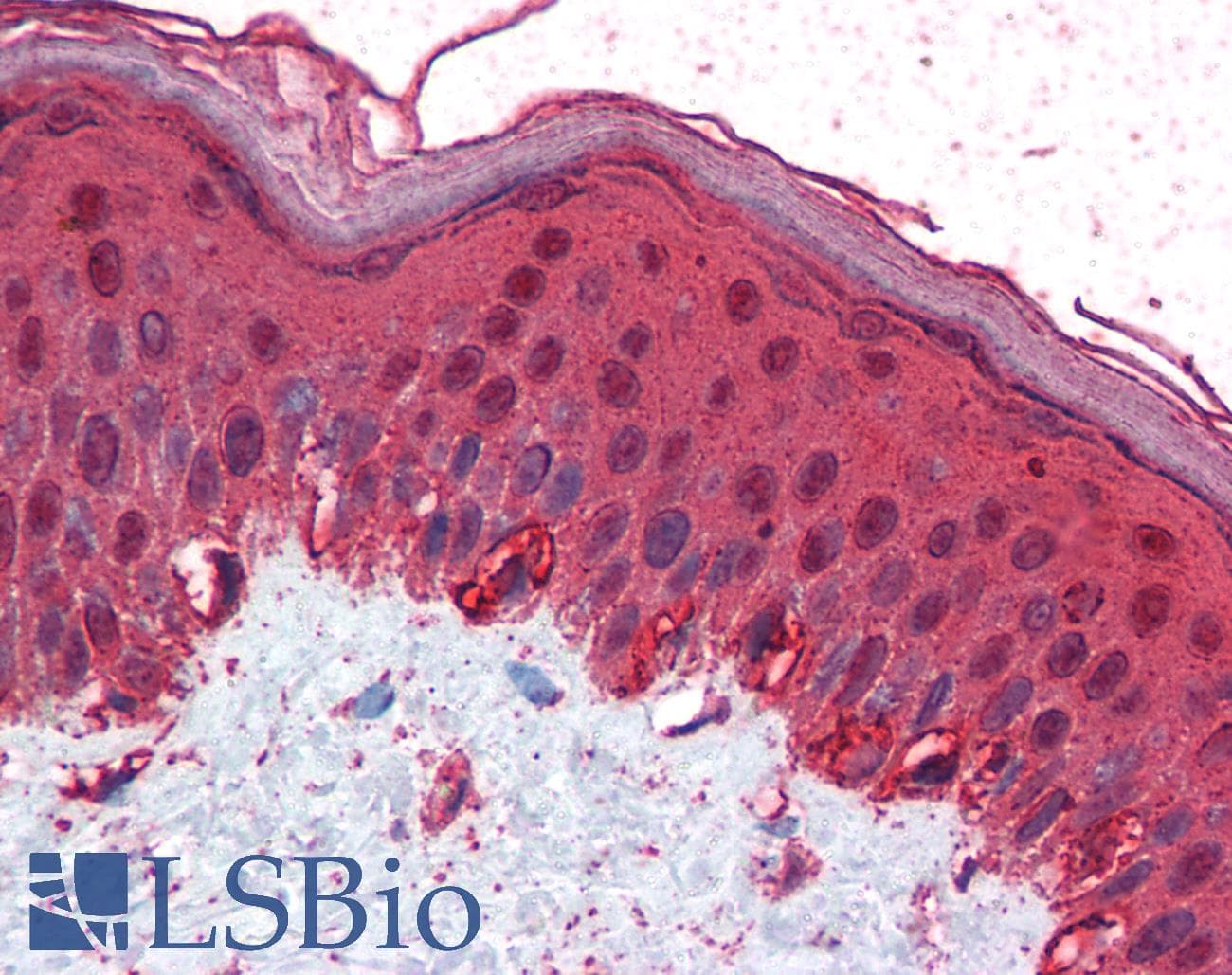IHC-plus™ Polyclonal Goat anti-Human TFAP2C / AP2 Gamma Antibody (aa270-281, IHC)