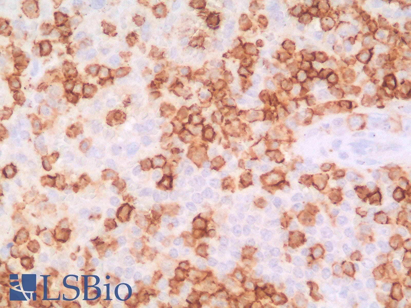 PathPlus™ SPN / CD43 Antibody (clone SPN/2049R)