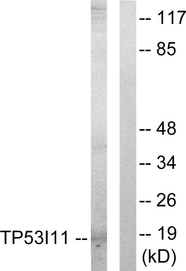 TP53I11 / PIG11 Antibody